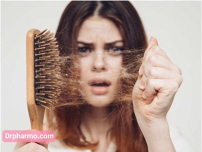 انواع مختلف و علل ایجاد ریزش مو یا آلوپسی