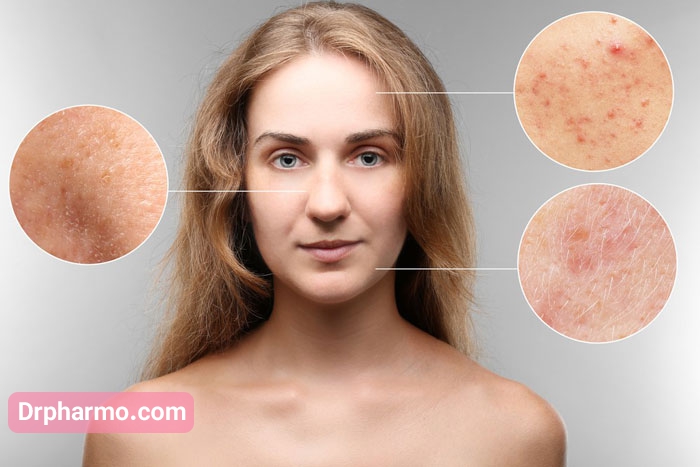 بیماری پوستی چیست؟