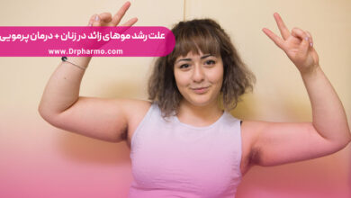 موهای زائد زنان