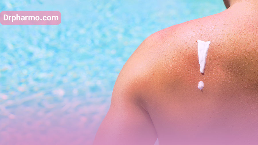 درمان آفتاب سوختگی پوست