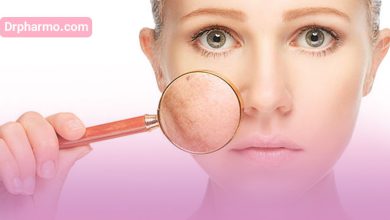 معرفی بهترین مارک کرم ضد لک قوی موجود در بازار