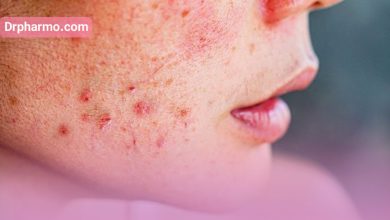 آشنایی با انواع بیماری های شایع پوستی