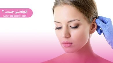 اتوپلاستی چیست