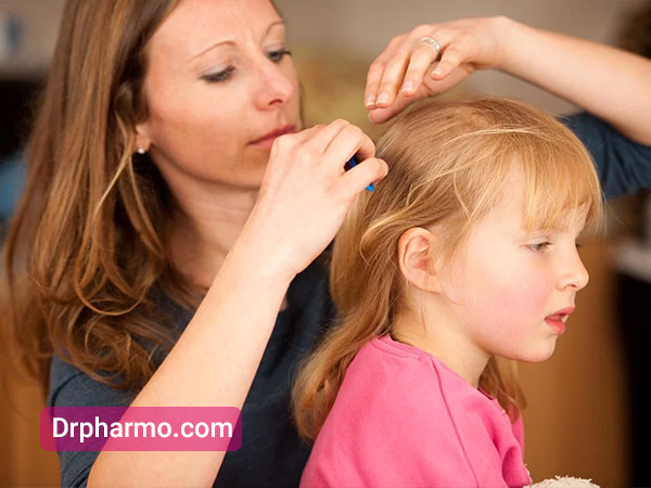 درمان خانگی شپش سر در کودکان 