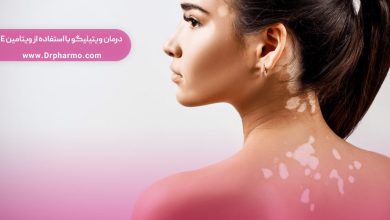 درمان-ویتیلیگو-و-خارش‌های-پوستی-با-استفاده-از-ویتامین-E