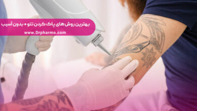 بهترین روش های پاک کردن تتو