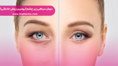 درمان سیاهی زیر چشم