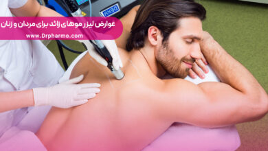 لیزر موهای زائد