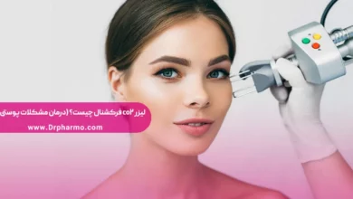 لیزر co2 فرکشنال چیست؟