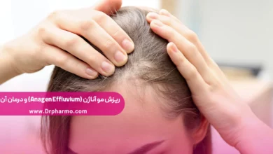 ریزش مو آناژن چیست