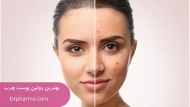 بهترین روتین پوست چرب و جوش دار