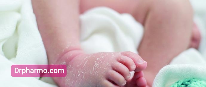 علائم خشکی پوست در کودکان